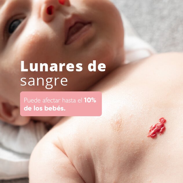 Lunares de sangre​