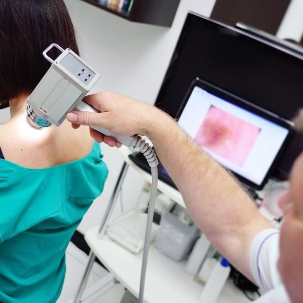 Dermatoscopia Digital Fotofinder​