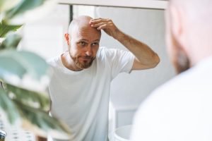 Close up de hombre con alopecia con sus manos en la cabeza