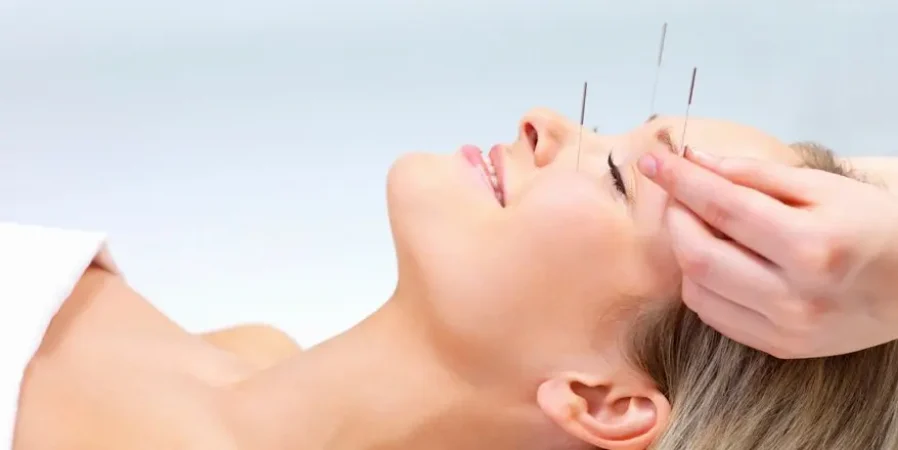 acupuntura-estetica