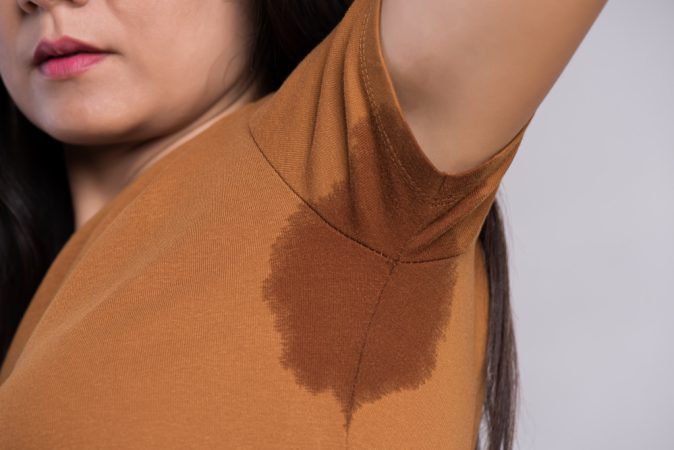 Mujer joven con hyperhidrosis en la axila
